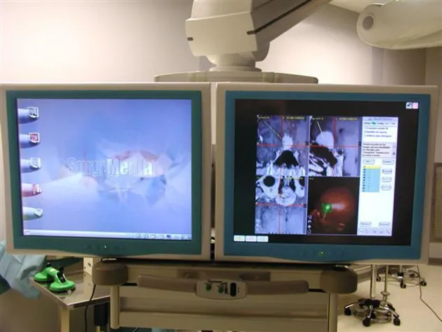 Bild: Immer gut im Bilde - Darstellungszentralen von OP-Daten