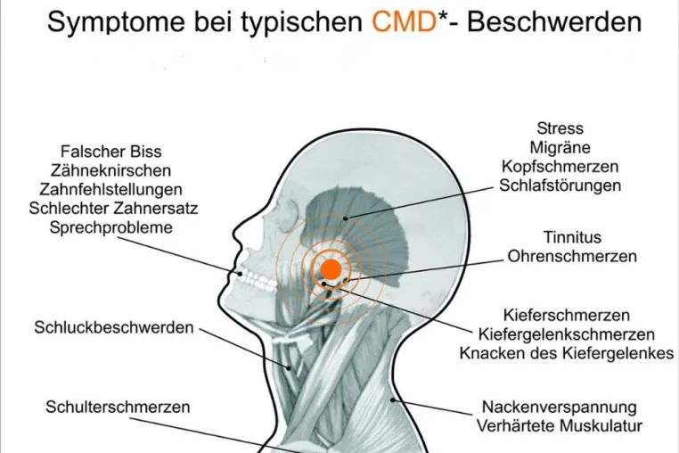 Bild: Ab wann macht Kieferknacken krank? - GZFA über die Funktionsweise des Kausystems