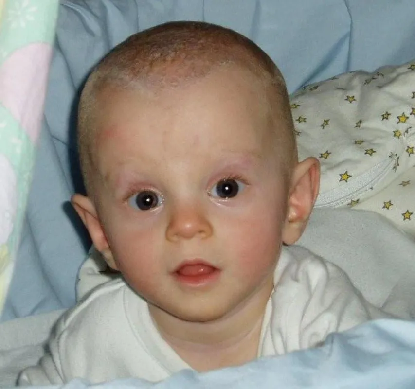Fast ein Wunder - Hannah ist heute völlig gesund