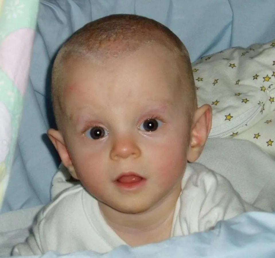 Fast ein Wunder - Hannah ist heute völlig gesund