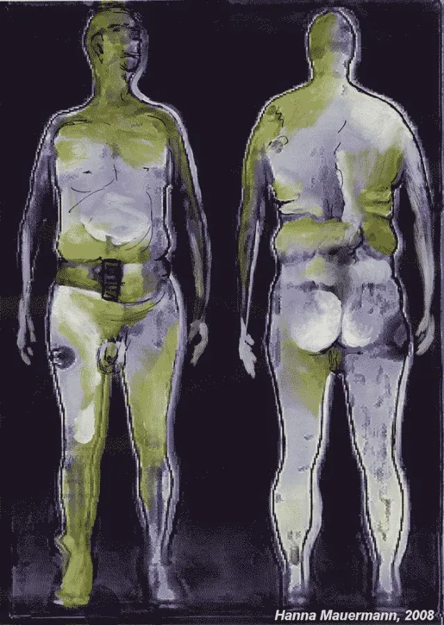 Hanna Mauermann  X - ray man; 2008, Fotografie am Computer bearbeitet, übermalt, Zeichnung, Druck