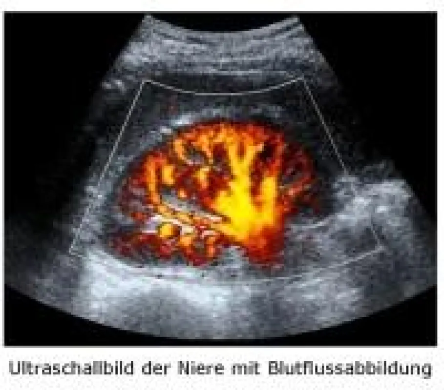 Ultraschallbild der Niere mit Blutflussabbildung