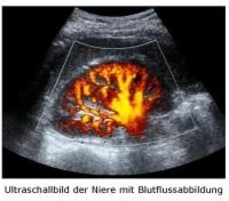 Bild: Diagnostische Ultraschallabbildung