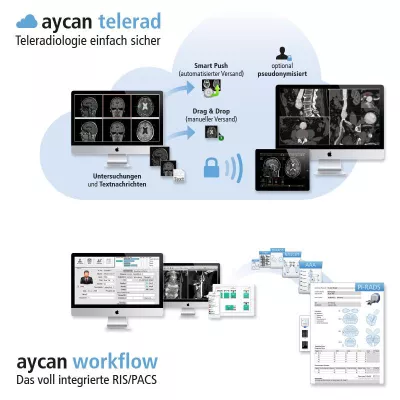 Bild: aycan auf dem Update RSNA in Köln und dem CT Kongress in Garmisch-Partenkirchen
