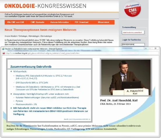 Bild: Neue Therapieoptionen beim malignen Melanom