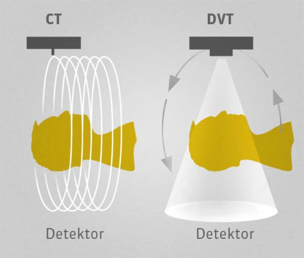 CT oder DVT | Grundlagen der Röntgendiagnostik als Teil der DVT-Fachkundekurse