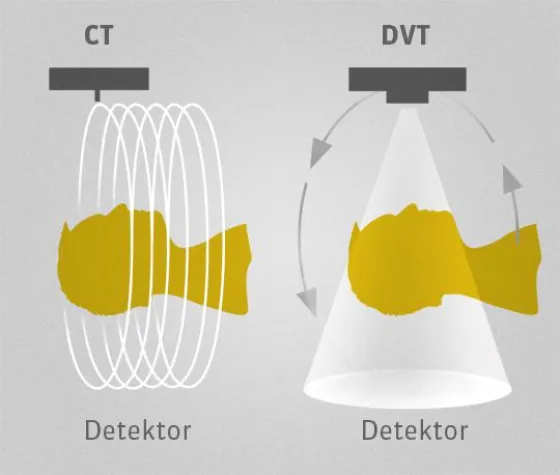 Bild: Neue Fortbildungskurse 2015 der DVT Akademie Deutschland und Gratis iPAD Valentins-Aktion.