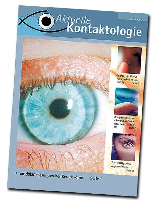 Die Zeitschrift für Kontaktlinsen anpassende Augenärzte