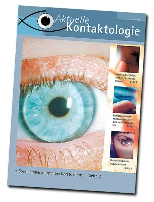 Bild: Neue Kontaktlinsen-Zeitschrift erscheint zum DOC-Kongress