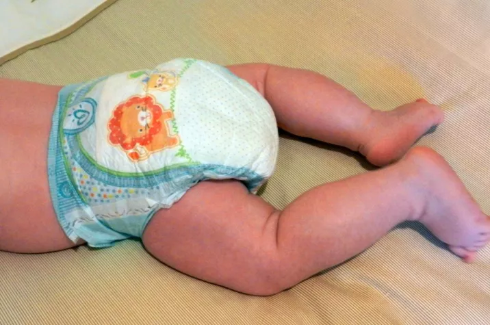 Bild: Wunder Baby-Po hat vielfältige Ursachen