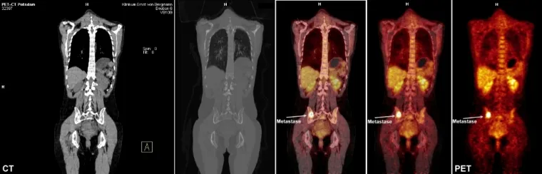 Bild: Inbetriebnahme eines PET-CT im Potsdamer Klinikum Ernst von Bergmann