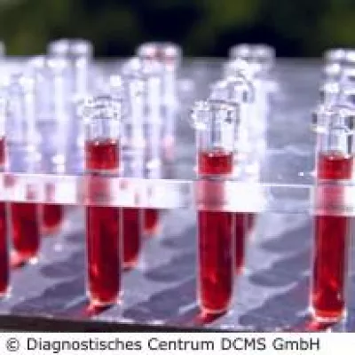 Optimierung des Stoffwechsels mit Vitalstoffen Bild: Optimierung des Stoffwechsels mit Vitalstoffen