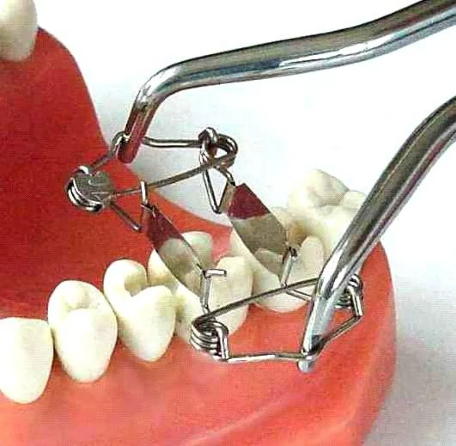 Matrize Zahn/Foto: Dr. Walser Dental GmbH