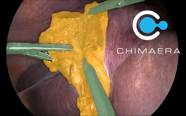 Bild: Chimaera ImViA: Plattform zur chirurgischen Videoannotation im produktiven Forschungseinsatz