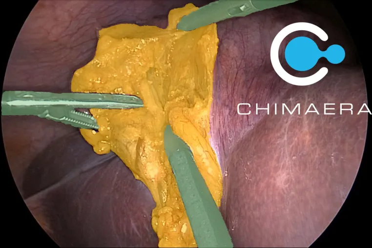 Bild: Chimaera ImViA: Plattform zur chirurgischen Videoannotation im produktiven Forschungseinsatz