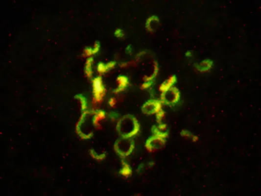 Bild: Zwei Wege, ein Ziel – Wie die Krone der Zellteilung entsteht