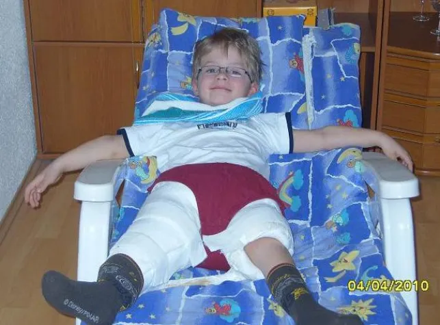 Bild: Deutsche Lebensbrücke bittet um Spenden für Jungen mit starken Geburtsfehlern