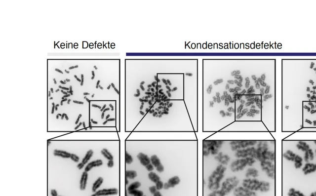 Bild: DNA rechtzeitig für die Zellteilung verpacken