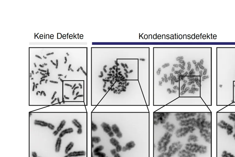 Bild: DNA rechtzeitig für die Zellteilung verpacken