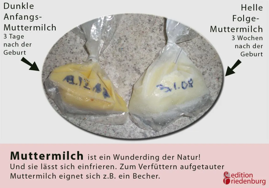 Muttermilch: Lässt sich einfrieren und sieht je nach Zeitpunkt der Gewinnung unterschiedlich aus