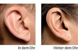 Bild: Ein oder zwei Hörgeräte? Hinter oder im Ohr?