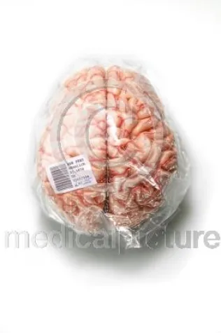 Bild: Heimspiel - medicalpicture auf der photokina