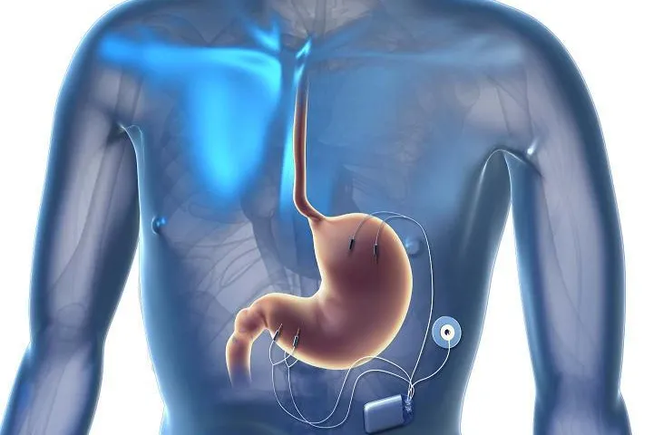 Bild: 5. Frankfurter Meeting für Adipositaschirurgie