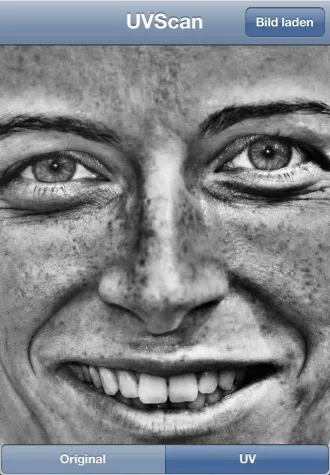 Bild: Visualisierung von Lichtschäden und Hautalterung mit dem iPhone