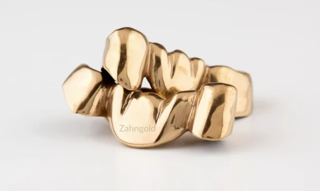 Bild: Zahngold Ankauf: GBLplus GmbH erweitert Service auf ganz Deutschland