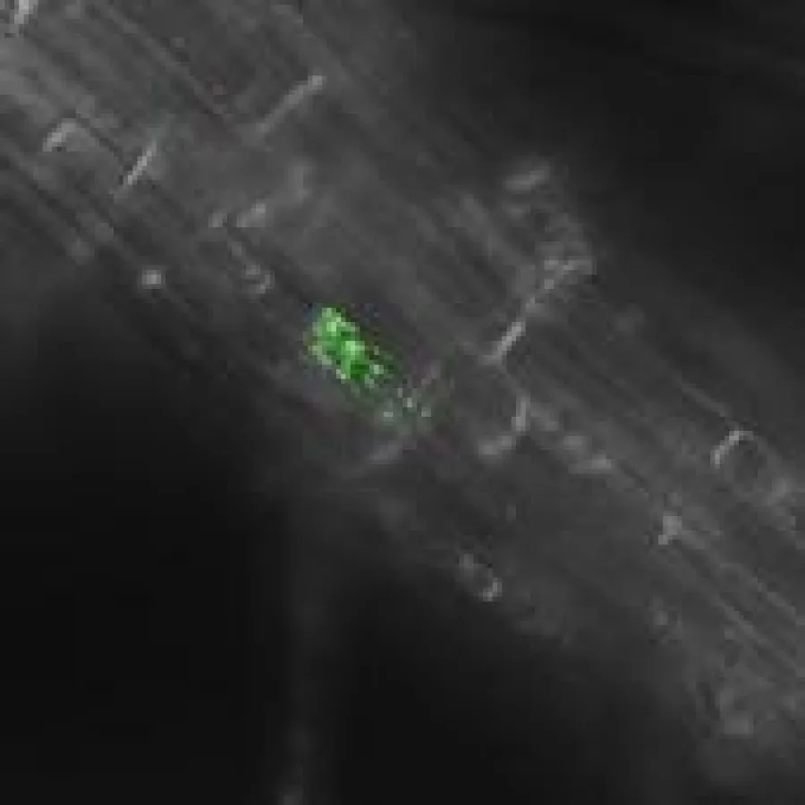 Auf dem Teller unscheinbar - hier durch Fluoreszenz gezeigt. Salmonellen in Pflanzenzellen.