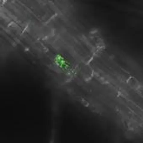 Bild: SALAT & SALMONELLEN - LEBENSMITTELVERGIFTUNG ALS BEILAGE