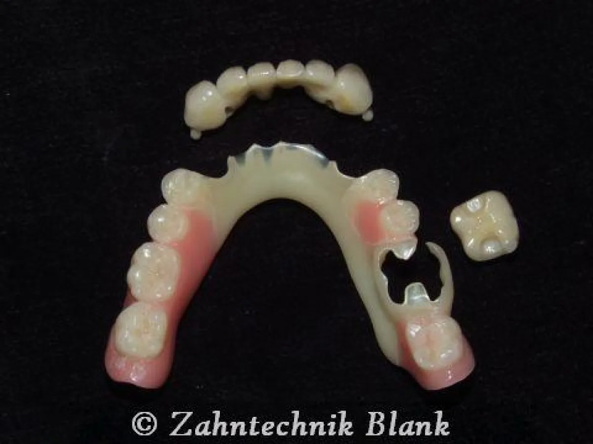 Arbeit aus Flexiplast