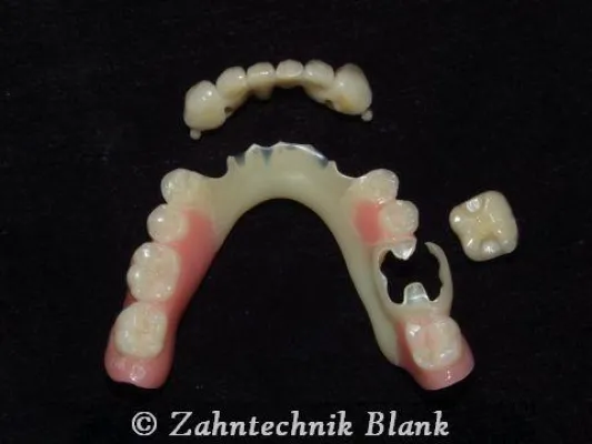Bild: Zahntechnik Blank – Innovation aus Tradition