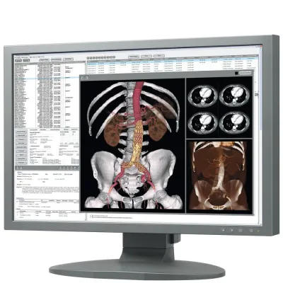 Bild: Widescreen- und Highbrightness-Monitore im Trend - TOTOKU zieht positives Fazit der MEDICA