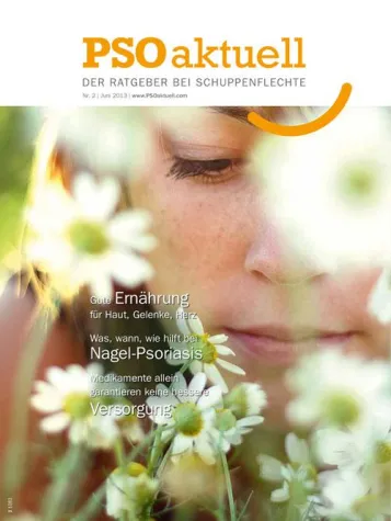 Nagel-Psoriasis: Wenn die Fingernägel nicht mehr schön sind Bild: Nagel-Psoriasis: Wenn die Fingernägel nicht mehr schön sind