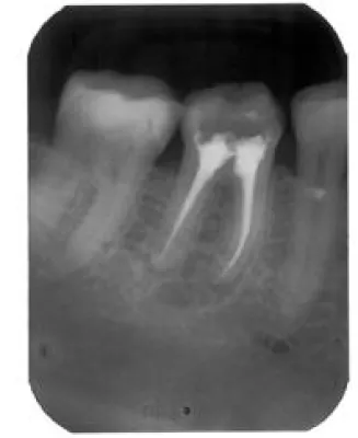 Bild: Gesund bis in die Wurzel – moderne Verfahren machen es möglich