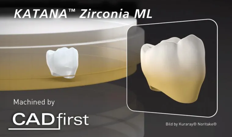 Bild: CADfirst Dental Fräszentrum integriert mehrfarbiges Zirkonoxid