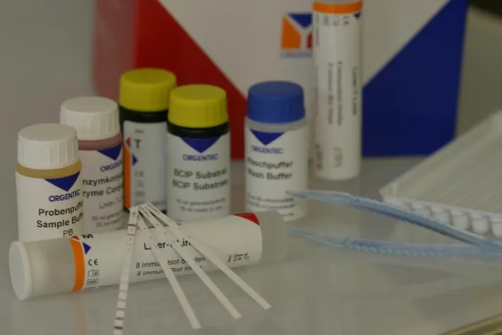 Bild: Labordiagnostik: Leber-Diagnostik mit Immunoblot-Testsystem