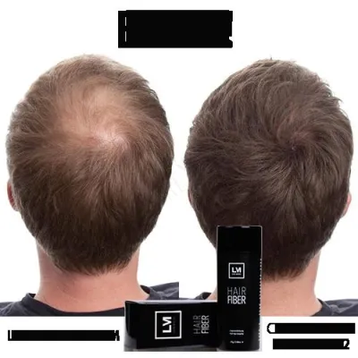 Bild: Volle Haare in 30 Sekunden! Ohne Haartransplantation!