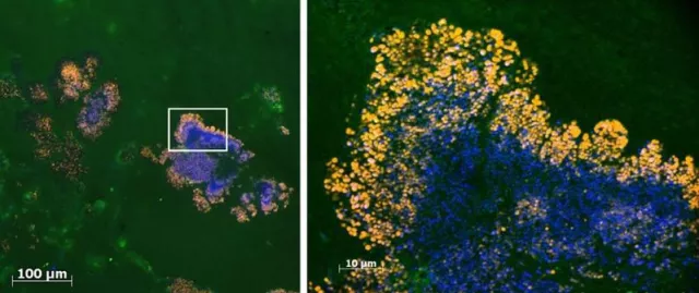 Bild: Infektionskrankheiten sicher und schnell erkennen