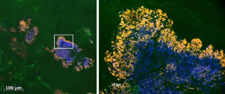 Bild: Infektionskrankheiten sicher und schnell erkennen