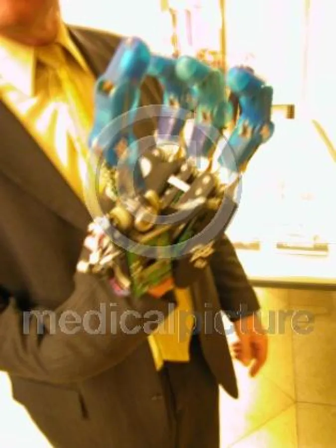 Beispiel einer neu entwickelten künstlichen Hand die per sensomotorik durch muskuläre Führung und Steuerung bewegt wird.