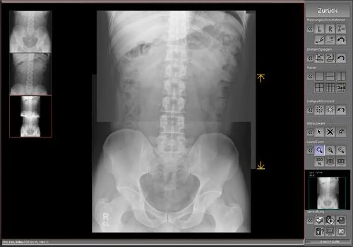 Die neue Stitching-Funktion