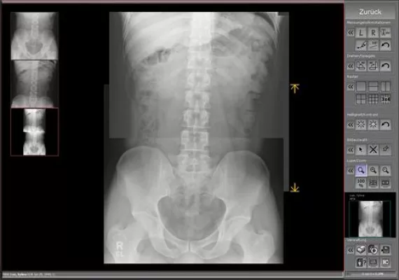 Bild: dicomPACS®DX-R 2.0 setzt neue Maßstäbe im Bildprozessing