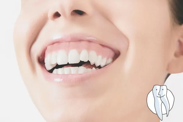 Bild: Schon vom Gummy Smile gehört