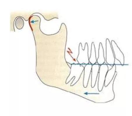 Rückenschmerzen wegen falschem Biss? - GZFA setzt auf interdisziplinäres Netzwerk Bild: Rückenschmerzen wegen falschem Biss? - GZFA setzt auf interdisziplinäres Netzwerk