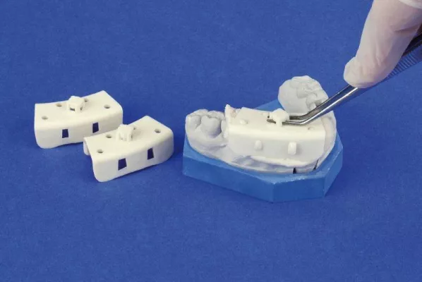 Bild: 94 % der Zahnmediziner sehen mit Miratray® Mini mehr Komfort für den Patienten