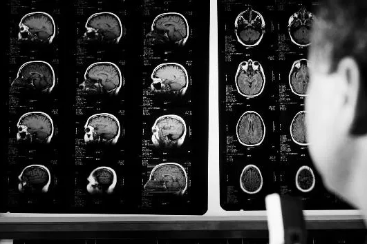 Bild: Diagnose Parkinson - Gemeinsame Initiative am 24. und 25.Juni