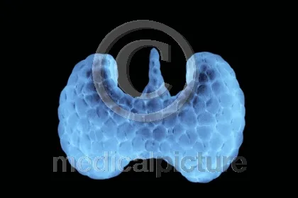 Bild: Der Schmetterling im Hals - die Schilddruese im medicalpicture Bildarchiv