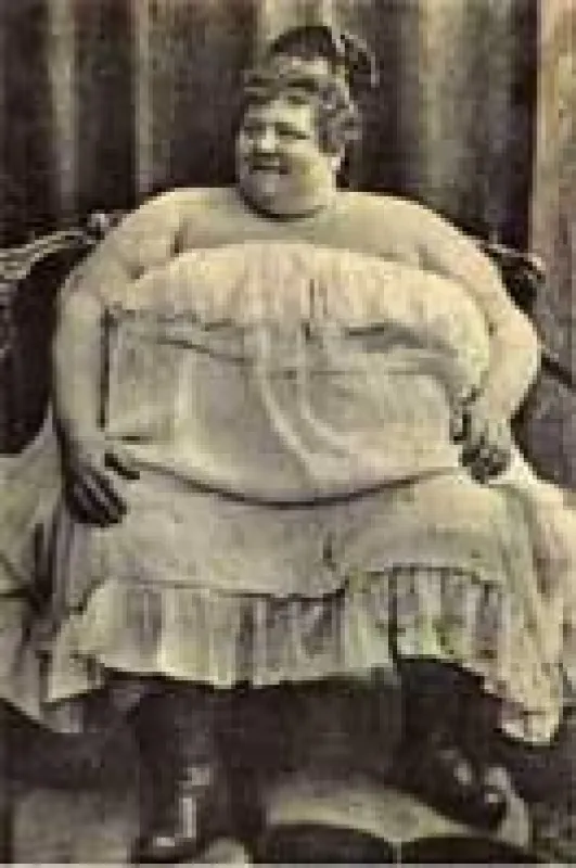 uebergewichtige Frau, ©medicalpicture